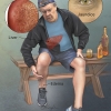 Cirrhosis