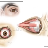 Muscles of the Eye