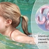 Cryptosporidiosis