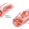 Normal and Clotted Capillary