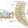 Cauda Equina Syndrome