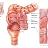 Layers of the Rectum